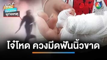 ตร.เร่งล่า แก๊งโจ๋โหดปาระเบิด ควงมีดไล่ฟันหนุ่ม 16 ปี นิ้วขาด | เช้านี้ที่หมอชิต