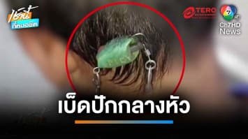 สยอง ! เพื่อนเหวี่ยงเบ็ดตกปลา พลาดปักหัว เด็ก 8 ขวบ | เช้านี้ที่หมอชิต