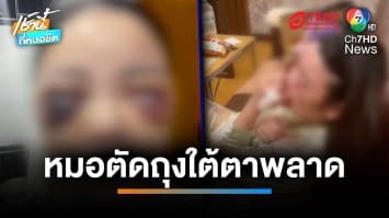 สาววัย 27 ปี ทำศัลยกรรม ตัดถุงใต้ตา หมอพลาดเกือบตาบอด | เช้านี้ที่หมอชิต