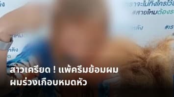 สาวเครียด ! แพ้ครีมย้อมผม ผมร่วงเกือบหมดหัว